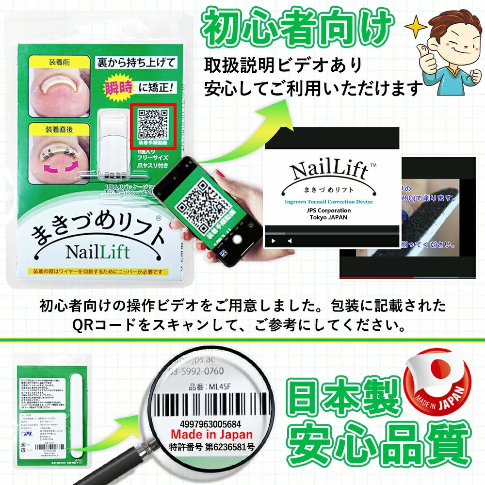 巻き爪リフト